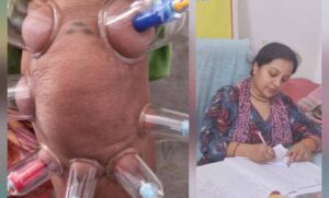 लोहरसी-आयुर्वेदिक-औषधालय-में-दर्द-प्रबंधन-हेतु-कपिंग-थेरेपी-एवं-विशेष-आयुर्वेदिक-उपचार-सेवाओं-का-आरंभ